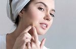 Hvorfor acne forekommer i ungdomsårene og forebyggelsen - skønhed
