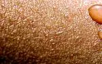 Hovedfunksjoner av huden - kuriositeter