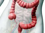 Ontsteking van de dikke darm: meest voorkomende symptomen en oorzaken