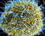 Как се разпространява ебола - заболявания