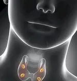 Masalah tiroid utama: penyakit dan keadaan tiroid