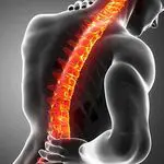 척추 측만증 : 원인, 원인, 증상 및 치료