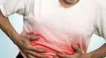 Crohnova bolest: što je to, simptomi i uzroci