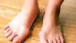 What are the bunions, why they appear and how to avoid them