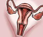Vaginal candidiasis, en stille sykdom som bare trenger kontroll