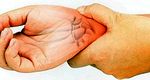 Carpal tunnel syndrome: what it is, its symptoms and causes that cause it
