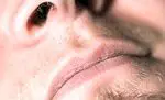 Ninapolüübid (massid või graanulid ninas): mida nad on, sümptomid ja ravi - haigused