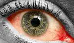 Por que o descolamento de retina ocorre?
