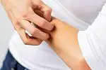 Dermatite atopique: symptômes, causes et traitement - les maladies