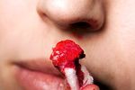 Epistaxia alebo krvácanie z nosa: príčiny, symptómy a liečba