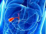 Main diseases of the gallbladder