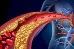 Cholesterol: main functions and what is it used for