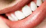 Healthy teeth: tips for healthy teeth - nutrition and diet