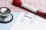 Blood cholesterol test: total, LDL and HDL