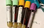 Vere pH: mis see on ja normaalväärtused