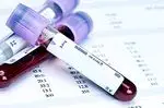 Triglyceride blood test: normal and abnormal values
